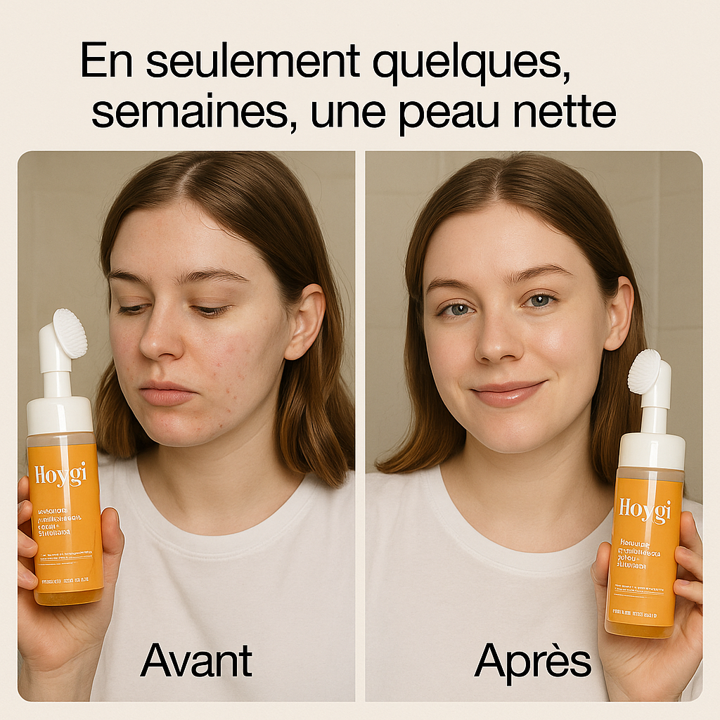 Nettoyant Visage Éclat TurmericTM