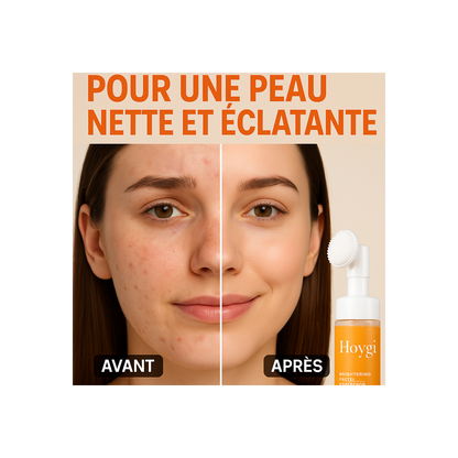 Nettoyant Visage Éclat TurmericTM